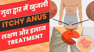 गुदा द्वार के खुजली का आसान इलाजFungal InfectionItchy anus fungalinfection treatment [upl. by Robinette915]