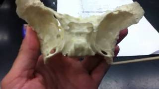 Sphenoid Bone [upl. by Kaasi]