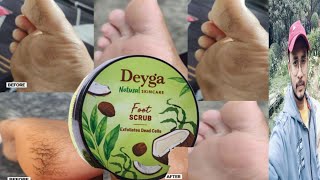 Deyga Foot Scrub  Honest Review [upl. by Hareehat789]