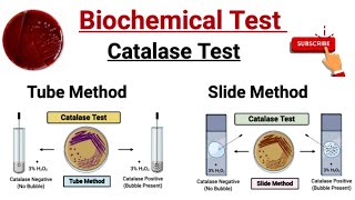 Biochemical Test For identification of Bacteria  Catalase Test  Test Tube Method Slide Method [upl. by Suirradal]