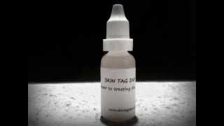 Skin Tag Remover  removing skin tags the natural way Skin Tag Zap [upl. by Idram663]