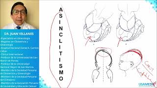 Distocias  Maniobras USAMEDIC  Obstericia 5 [upl. by Ahsilaf309]