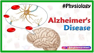 Alzheimers disease  Etiology Pathophysiology Signs and symptoms Diagnosis and Treatment [upl. by Whiffen]