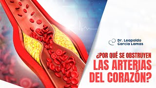 ¿Por qué se obstruyen las arterias del corazón  Dr Leopoldo García Lamas [upl. by Erialcyram]