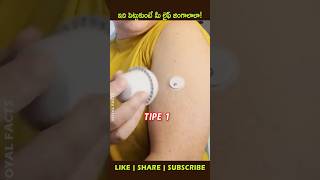 CGM Device for Diabetesyoutubeshorts factsintelugu shortvideo shortsfeed [upl. by Annek469]