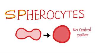 Spherocytes [upl. by Waxman389]