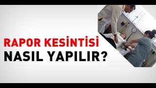 Maaşlardan Rapor Kesintisi Nasıl Yapılır Rapor Kesintisi Hesaplama [upl. by Reginauld480]