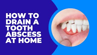 Should you Drain a Tooth Abscess at Home [upl. by Camey305]