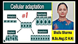 Cellular Adaptation TypesAtrophy HypertrophyPhysiological and pathological Atrophy [upl. by Aicekat810]