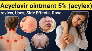 Acyclovir Ointment Uses  Review Acylex ointment uses Side effects contraindications [upl. by Knighton691]