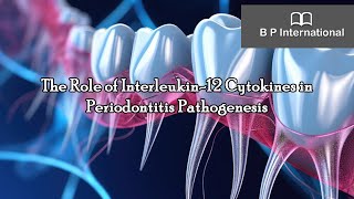 The Role of Interleukin12 Cytokines in Periodontitis Pathogenesis [upl. by Ttimme731]