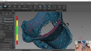 Transmission Casing Scan with a Scantech3D Kscan 20 3D Scanner [upl. by Renee]