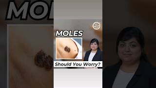 Moles Are they Cancerous moles shorts drniveditadadu youtube [upl. by Nica]