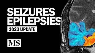 Seizures and Epilepsies 2023 [upl. by Bary761]