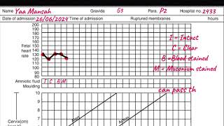 Partograph  How to plot the Partograph A step by step guide griphsacademy2024 [upl. by Euqinna118]