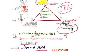 Juvenile Idiopathic Arthritis JIA  Juvenile Rheumatoid Arthritis JRA  mnemonic [upl. by Eelrehpotsirhc]