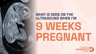 Week 9 of Pregnancy Ultrasound Brain Heart amp Gender Development [upl. by Anuala]