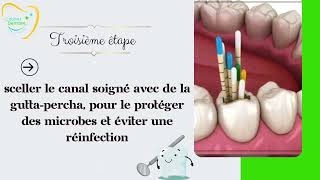 Traitement endodontique  canalaire [upl. by Deborah789]