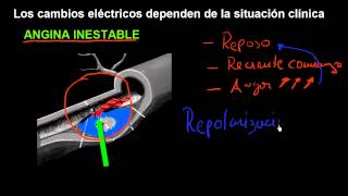 CURSO DE EKG 32  ELECTROCARDIOGRAFÍA DE LA CARDIOPATÍA ISQUÉMICA  INTRODUCCIÓN CLÍNICA [upl. by Loise]