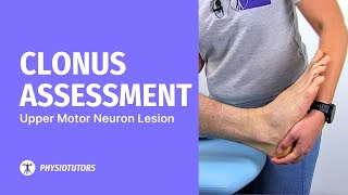 Clonus Assessment  Upper Motor Neuron Lesion [upl. by Anirual]