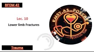 Lecture 10  Lower Limb Fractures  Trauma 42 [upl. by Gnues]