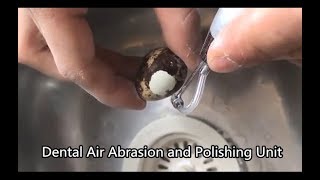 The Amazing Effect of Dental Air Abrasion and Polishing Unit [upl. by Dnalram]