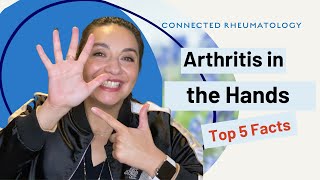 Arthritis in the HandsTop 5 Facts to know when you have hand arthritis [upl. by Enyaj]