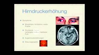 Basiskurs Neurologie Hirndruck Teil 314 [upl. by Park]