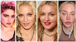 What happened to Madonnas face [upl. by Adiraf]