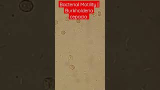 Bacterial Motility Burkholderia cepacia Blood Culture bacteremia [upl. by Nitz]