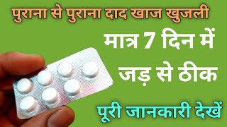 Dad Ki Dawa  सिर्फ 7 दिन में दाद खाज खुजली जड़ से ठीक  Terbicad 250 Tablet  dad ki dawai [upl. by Chap]