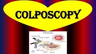 What is a Colposcopy  Colposcopy  Biopsy Purpose Procedure Risks and Results [upl. by Lerual]