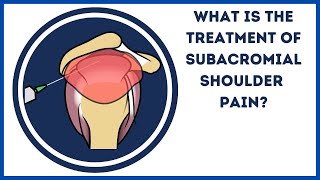 What is the treatment of subacromial shoulder pain [upl. by Fairman274]