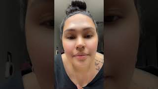 Part 1 Face pimple patches fyp foryou pimplepatch momblogger momvlog [upl. by Rossner129]