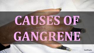 CAUSES OF GANGRENE [upl. by Lordan600]