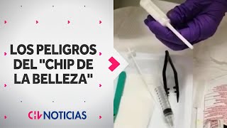 LOS PELIGROS del popular quotChip de la Bellezaquot Modelos lo usan para mantener quotapariencia juvenilquot [upl. by Anhavas]