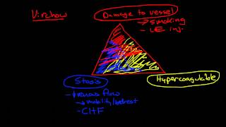 Thromboembolic Disease Deep Vein Thrombosis and Pulmonary Embolism [upl. by Glenna209]