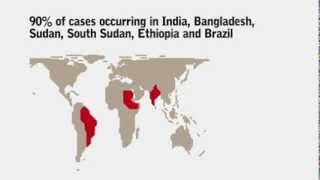 What do you know about Visceral Leishmaniasis Kala Azar [upl. by Joanna]