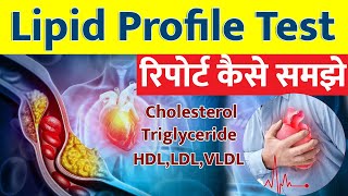 Lipid profile test in Hindi I Lipid profile Test Report कैसे समझे I [upl. by Rosanna]