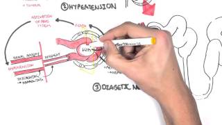 Chronic Kidney Disease CKD Pathophysiology [upl. by Ellinej]