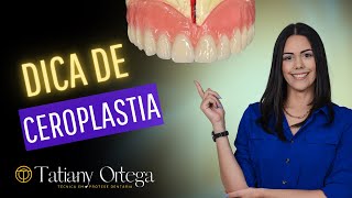 Dica de ceroplastia [upl. by Mirella122]