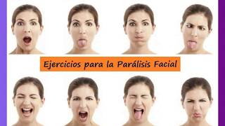 Parálisis facial  Rehabilitación 😣 [upl. by Aloeda]