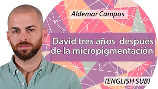 👉❗INCREÍBLE❗ David 3 años después de la micropigmentación capilar ENGLISH SUB [upl. by Ewold]