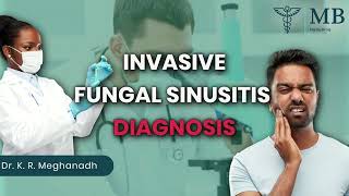 Invasive fungal sinusitis diagnosis  Dr K R Meghanadh  Medyblog [upl. by Nitas]