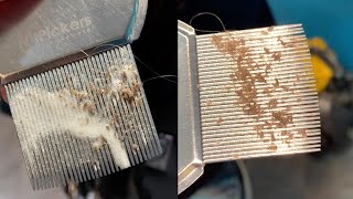 CloseUp Of Lice Infestation Removal [upl. by Ailad]