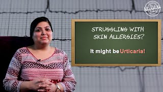 पित्ती  URTICARIA  को जड़ से मिटाने का उपचार  Urticaria or Hives explained by Dr Nivdita Dadu [upl. by Haseena]