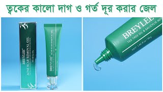 ব্রনের কালো দাগ ও গর্ত দূর করার জেল Breylee Acne Scar Removal Gel [upl. by Melvina]