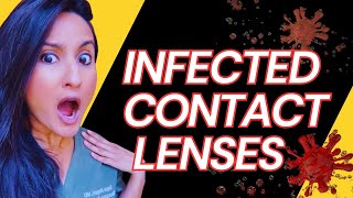 Halloween Gone Wrong Bacteria In Scary Contact Lenses  Costume Contact Lenses  Colored Contacts [upl. by Gwynne]