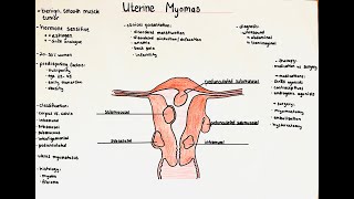 Uterine Myomas  definition histology classification clinics [upl. by Eba]