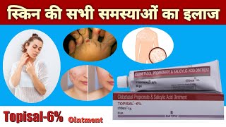 Topisal 6 Persent Ointment For Acne Pimples Psoriasis Skin Infection Eczema Contact Dermatitis [upl. by Eeresed]